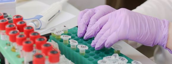 Laboratorium Inspekcji Sanitarnej w Siedlcach uruchamiają diagnostykę w zakresie COVID 19