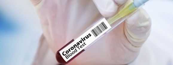 Dwie osoby zakażone koronawirusem zmarły