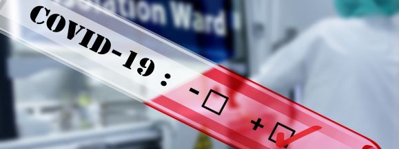 W  szpitalach w związku z koronawirusem przebywa 289 os&oacute;b