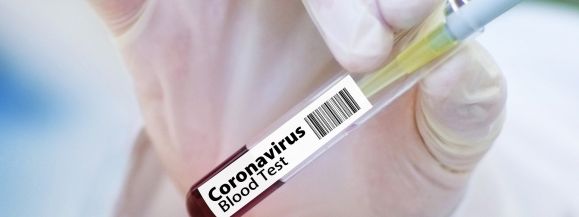 Ognisko w lokalu gastronomicznym