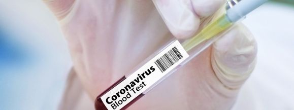 9 nowych zakażeń w powiecie