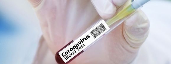 Liczba skierowanych na kwarantanę w ciągu ostatniej doby przekroczyła 500 os&oacute;b