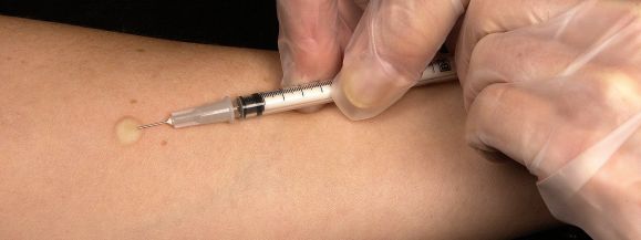 W szpitalach nieznacznie mniej pacjent&oacute;w w związku z koronawirusem 