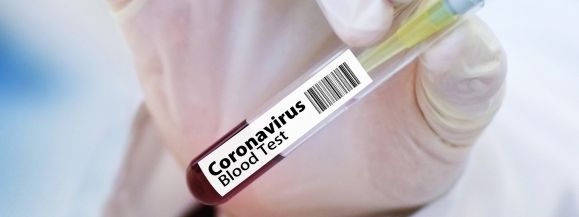 Bieżące informacje w liczbach na temat koronawirusa w Siedlcach (16.09.)