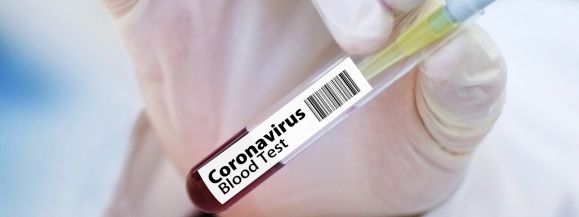 Ostatniej doby zmarło 2 osoby