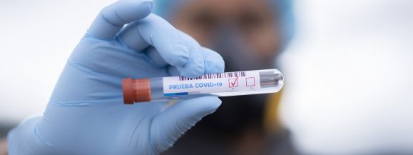 7 os&oacute;b zmarło, a blisko 260 os&oacute;b hospitalizowanych 