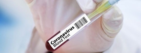 Kilkanaście nowych zakażeń w powiecie siedleckim. Bilans dnia