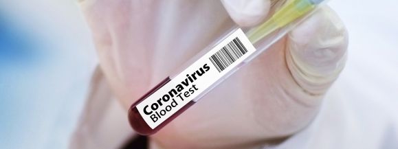 Sześć os&oacute;b zakażonych koronawirusem zmarło w szpitalach 